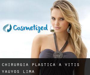 chirurgia plastica a Vitis (Yauyos, Lima)