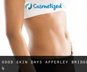 Good Skin Days (Apperley Bridge) #4