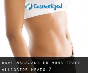 Ravi Mahajani Dr MBBS, FRACS (Alligator Heads) #2